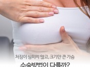 가슴 크기는 큰데 처짐이 심하지 않은 경우 수술 방법이 달라질까?